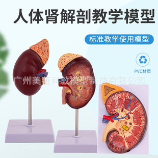 人体肾脏模型 肾解剖附肾上腺放大模型病变肾脏 人体内脏器官解剖-阿里巴巴