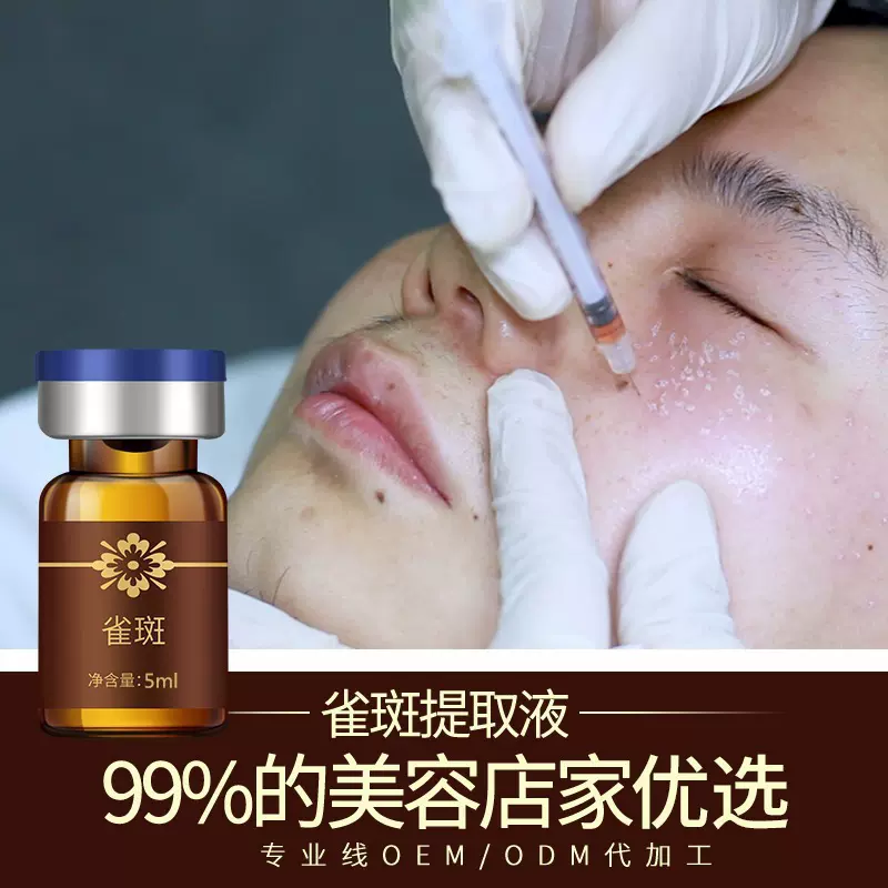 真皮班提取液美容院溶斑素点斑水调理排班代谢液黄褐班色素分解液