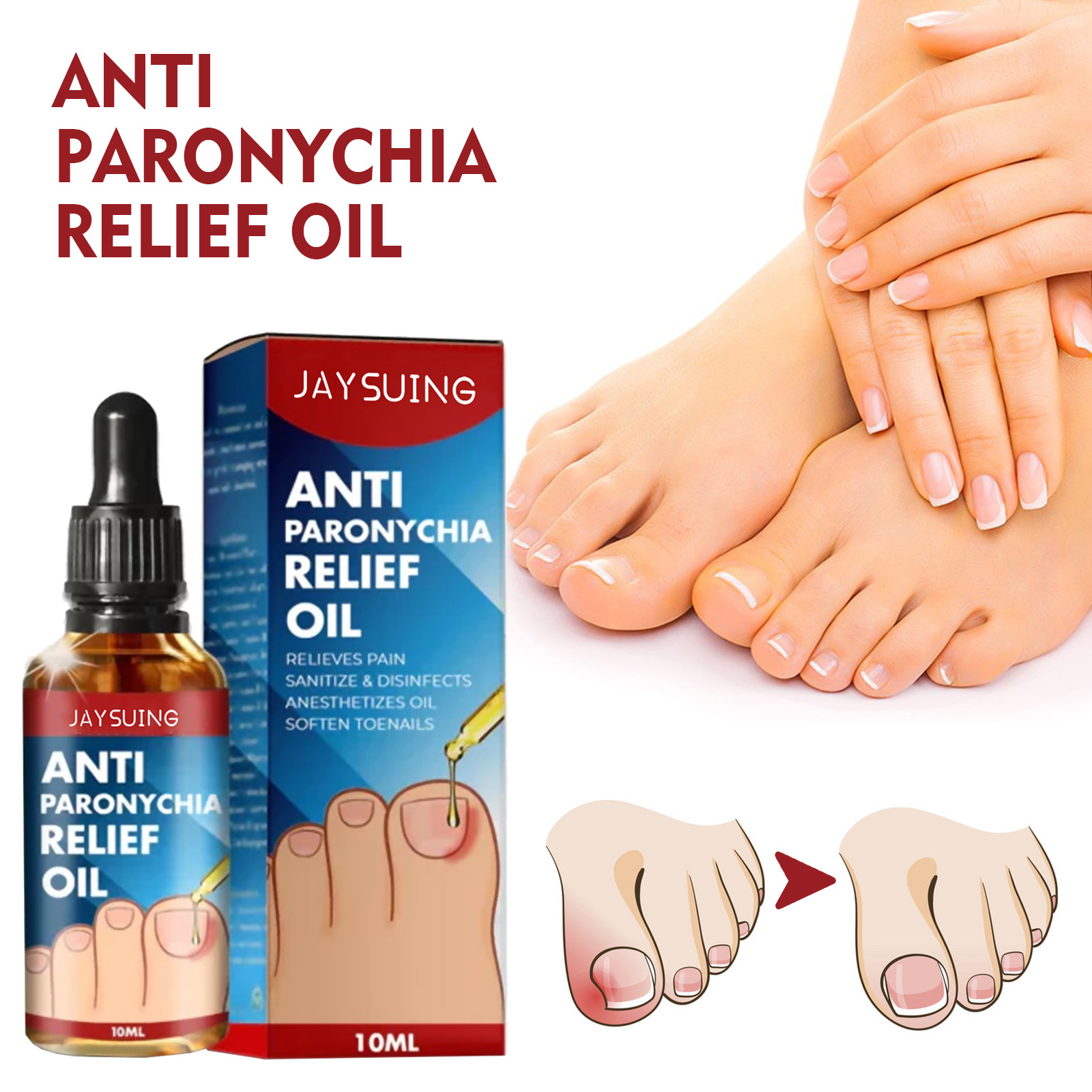 Jaysuing Anti-Arch Nail Relief Oil, Soft Nail, Shiny Nail Repair, Embedded Nail Thickening Type, Gray Nail Matrix Care Oil