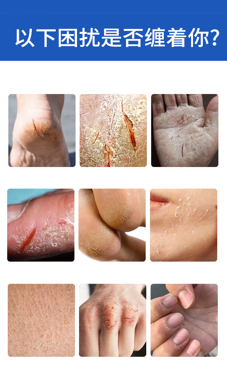 Yao Benren Vitamin E Horse Oil Cracked Skin Ointment 20g External Skin Care Balm specifications