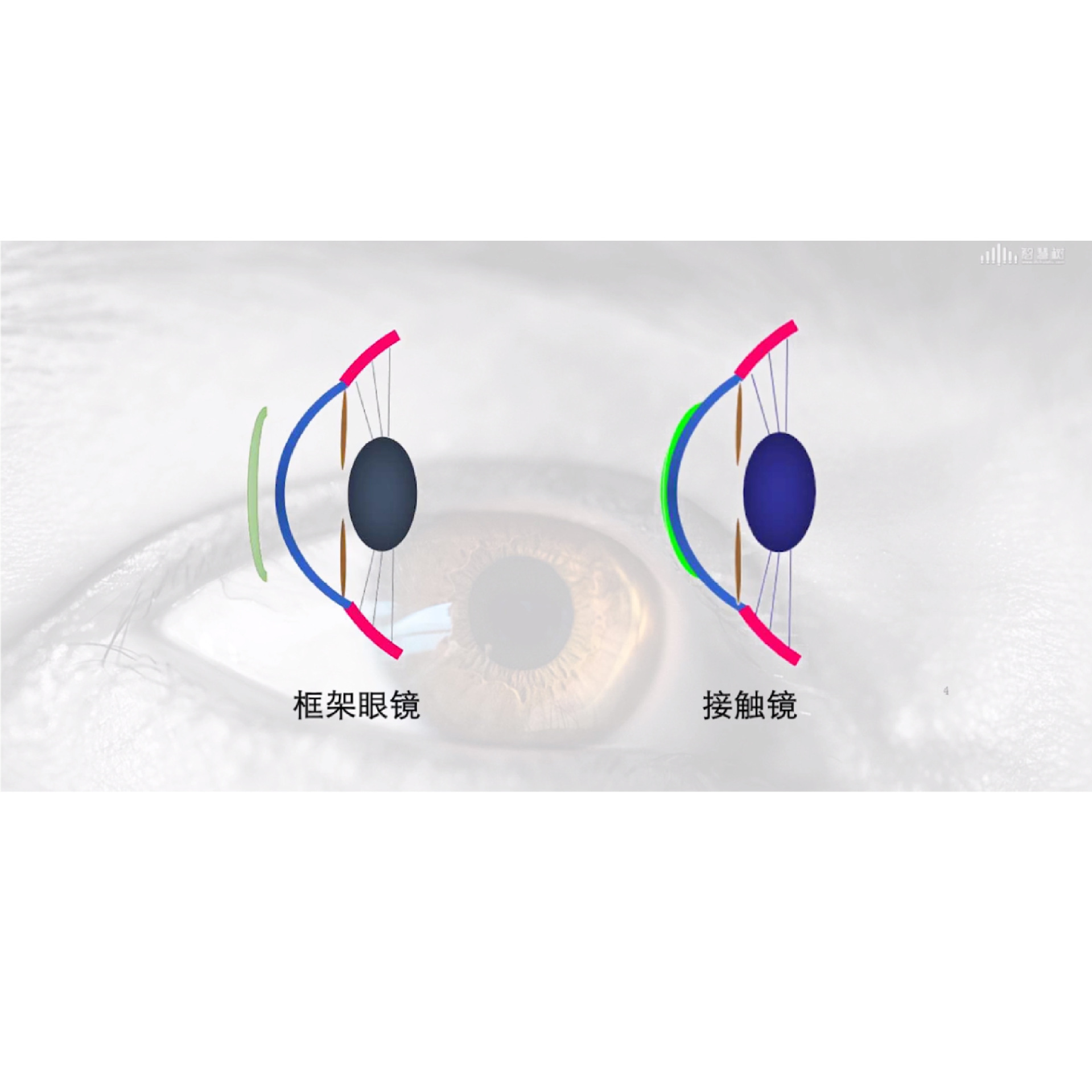 ���Ӻ������ȷ����2����Ĥ�Ӵ���  �γ�����