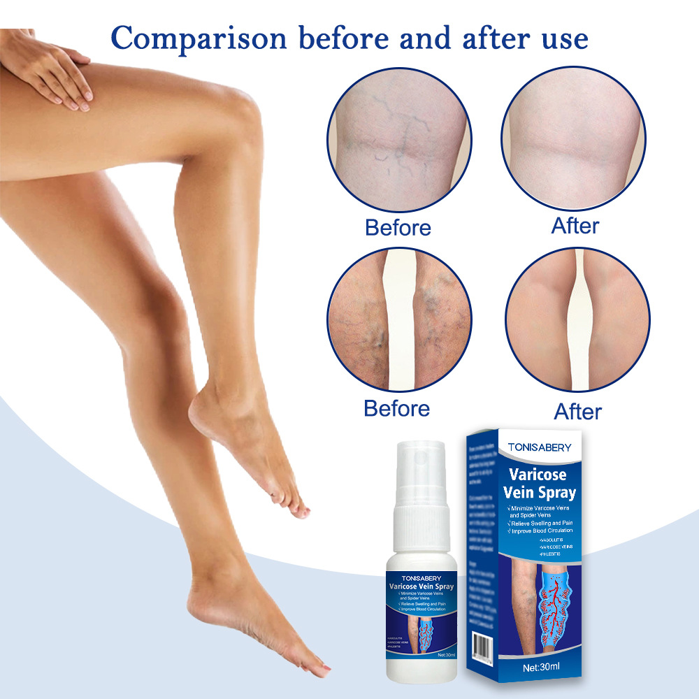 Spezielles 30ml Quzhang Regenwurm Bein-Aktivierungsspray zur intravenösen Massage_voghion.com