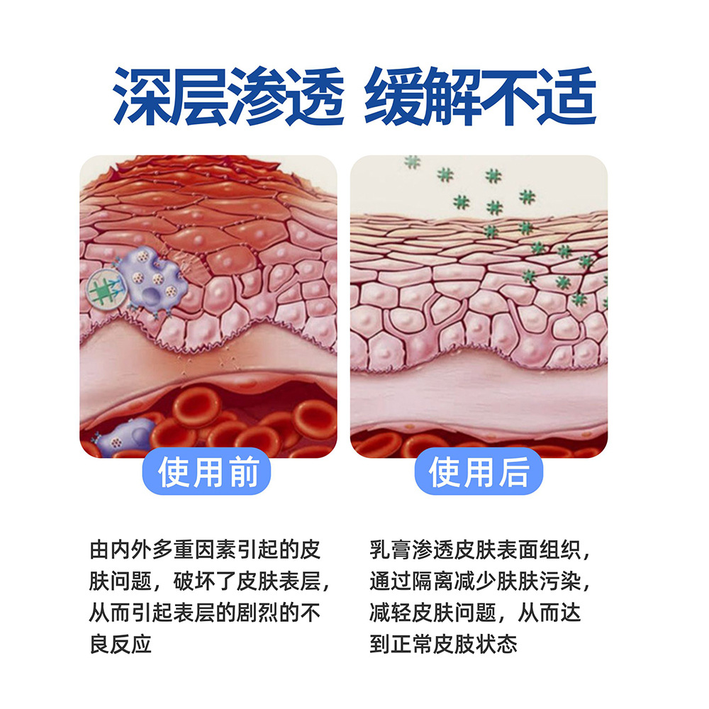 硫磺軟膏皮膚外用抑菌膏蟎蟲疥蟲叮咬草本護理膏消癢止癢膏