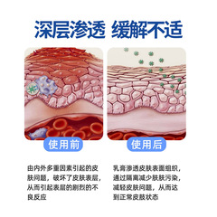 硫磺軟膏皮膚外用抑菌膏蟎蟲疥蟲叮咬草本護理膏消癢止癢膏