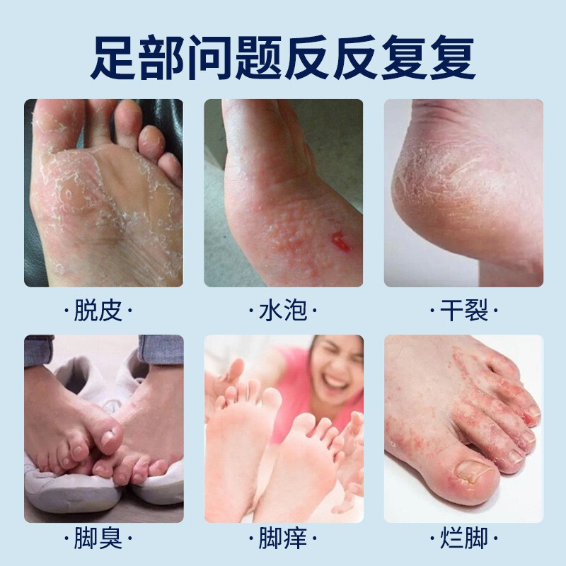 香港百年大药房联苯苄锉抑菌液套装止痒脚臭脚汗脚痒喷雾抑菌套装|undefined