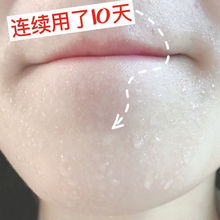 ��e�ִ�ë�װ۲������������տsë�׾��AҺ�������Ό��ȥ�ڷ۴�