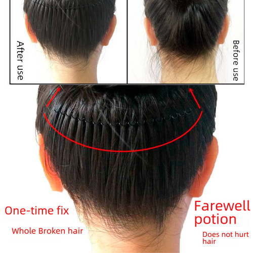 Hair Breakage Remedy Organizer, Frizz Control Clips, Top Clips, Fixed Insert Comb Hair Pins for Women, Hair Dandruff Prevention, Styling Hair Comb Edge Clips