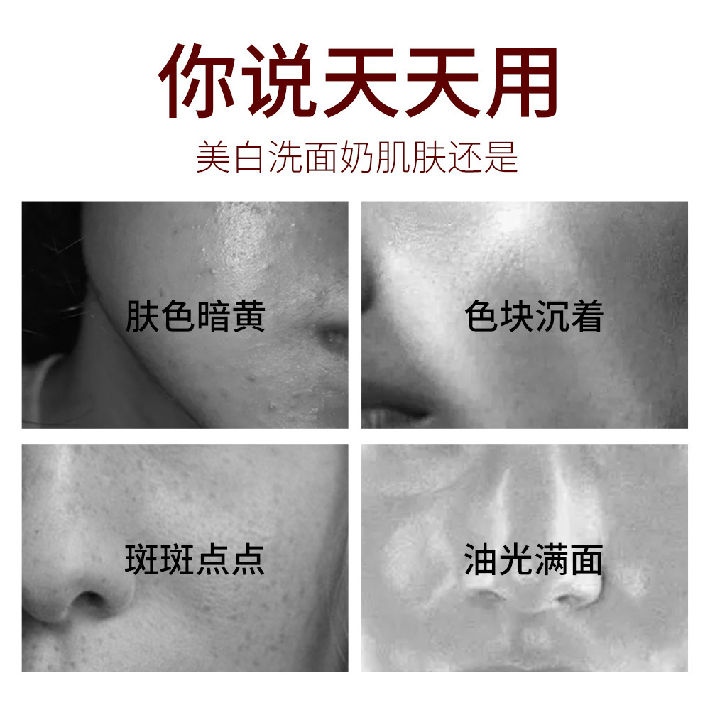 Sandy Nel Skin Care Whitening and Spot Removing Cleanser Deep Cleansing Hydrating and Moisturizing Gentle Facial Cleanser Wholesale