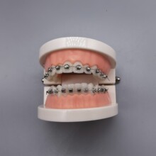 牙科正畸带托槽牙齿模型球形自锁托槽矫正练习示范教学展示模型