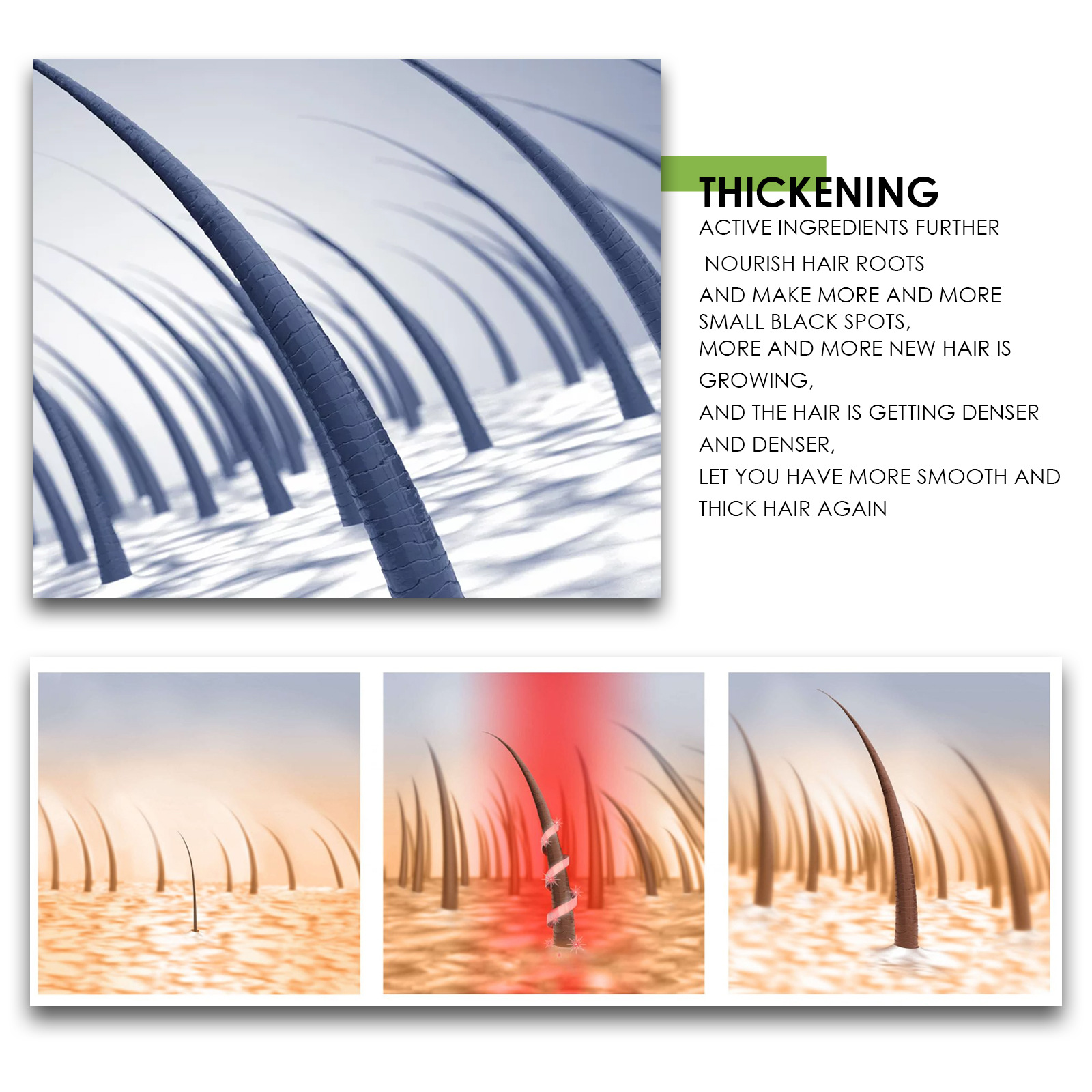 OUHOE Growth Kräuteressenz Feuchtigkeitsspendende, straffende, dichte Haarpflege_voghion.com