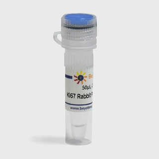 AB2008 Ki67 Rabbit Polyclonal Antibody 碧云天生物