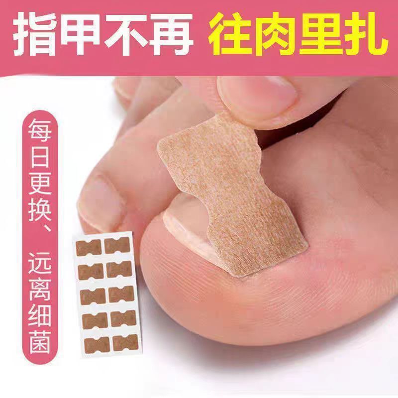 Factory glue-free nail stickers toenail groove nail orthosis toenail patches for Lala manicure