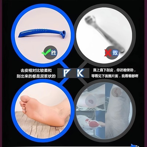 Foot care essential dead skin remover pumice stone callus home use foot file heel scraper keratolytic
