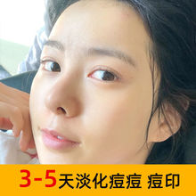 �۲����҃�����侫�AҺ�澏���oԭҺ�沿�aˮ������ӡŮ��ʿ