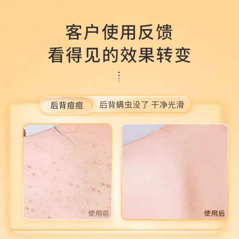 南京銅仁堂硫黄ダニ除去液体石鹸青椒ダニを除去し、肌を優しく若返らせ、かゆみを和らげます、卸売および配送用に在庫あり|undefined