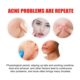 The Same Style of Ready-Made Transparent Universal Acne Star Acne Patch Invisible Acne Removal Waterproof and Sweat-Proof Youth Acne Patch