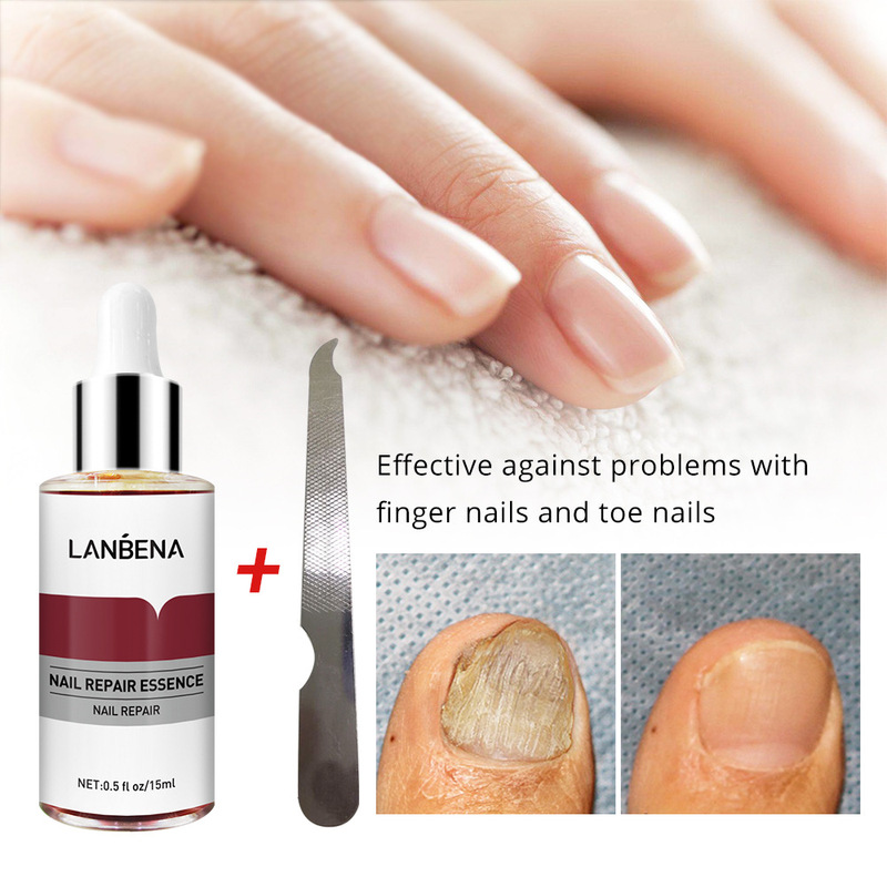 Lanbena Nail Care Essence with Small File 15ml (New Packaging) Lb6139