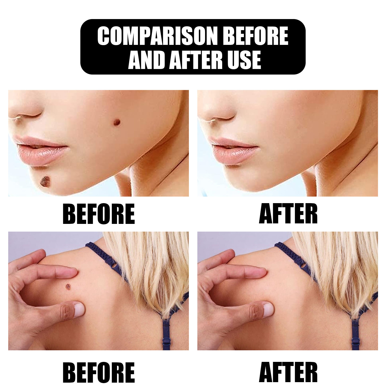 EELHOE Skin Care Essence Gentle Cleansing Care Skin Face Neck Care Smooth Skin Essence
