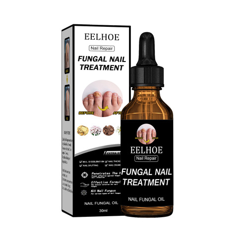 EELHOE Nail Repair Solution Thickening Bright Nails Remove Onychomycosis Dead Skin Repair Moisturizing Nail Art Nutritional Care Solution