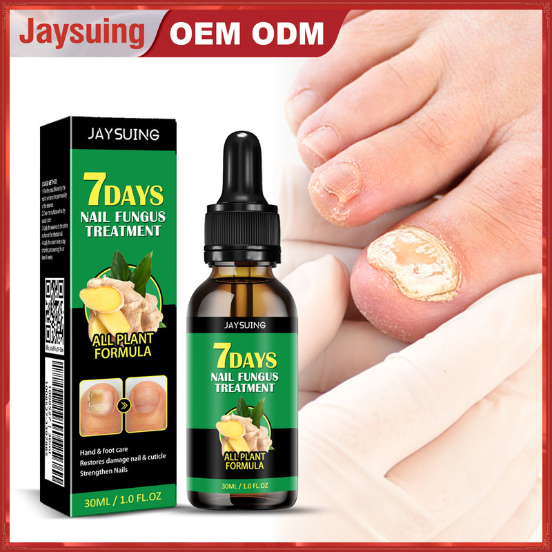 Jaysuing Ginger Nail Care Solution Protects Onychomycosis and Repairs Ginger Nail Care Solution