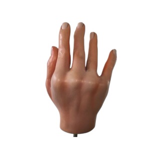 Wind-like shi joint yan display model hand lesions pathological model