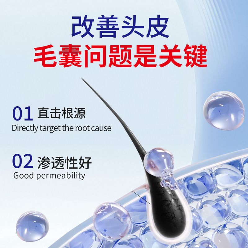 煤焦油洗剂头皮疙瘩毛囊受损堵塞清洁头皮痒止痒脂溢性洗剂洗头水|undefined