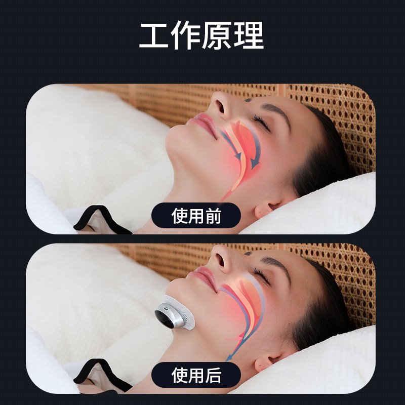 Cross-Border New Model Smart Throat Massager Dual-Pulse Anti-Snoring Device Snoring Massager Home Electric Anti-Snoring Device