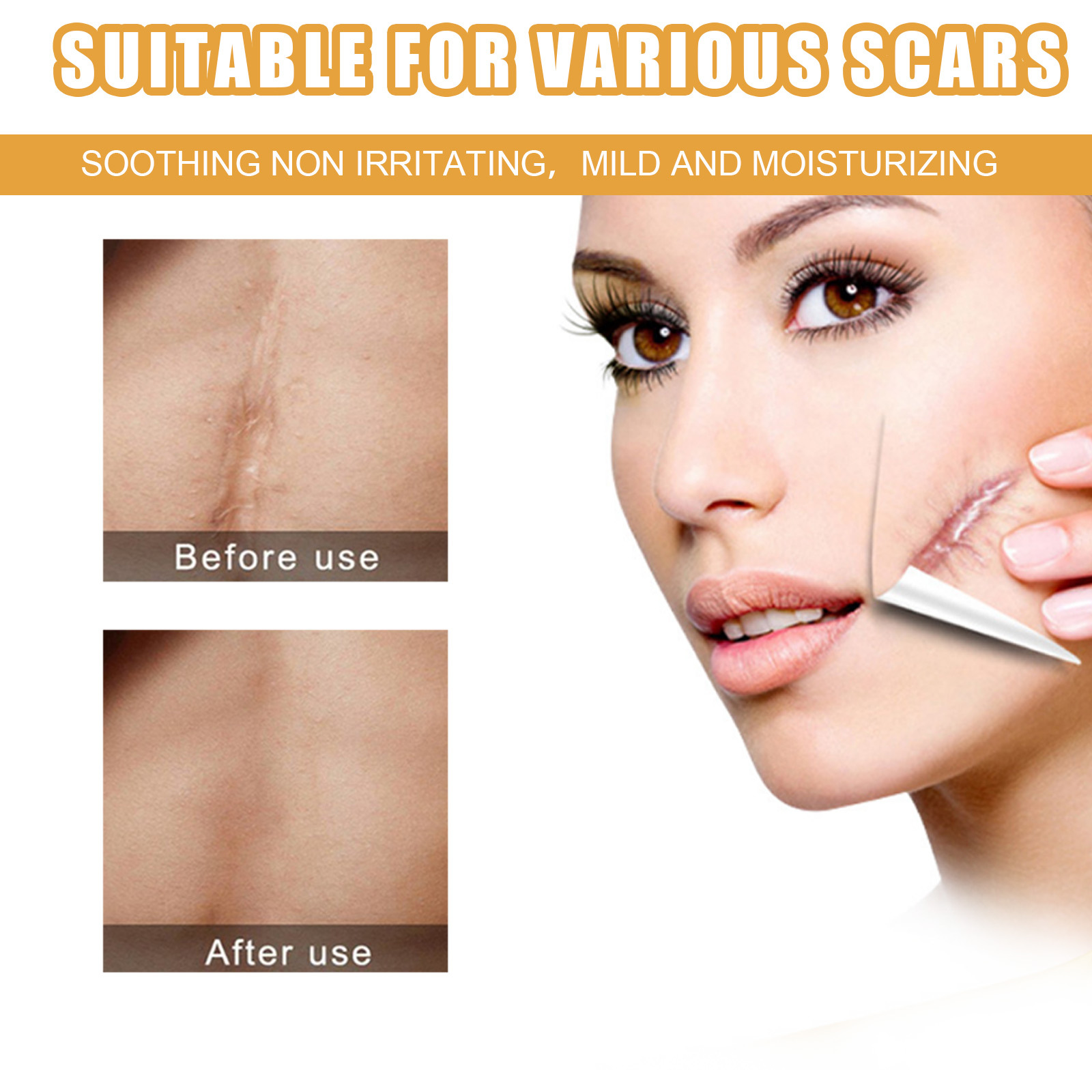 EELHOE Scar Cream Fading Hud Trauma Reparation Forbrænding Forbrænding Fading Cream Kirurgisk reparation Scar Scar Cream_voghion.com