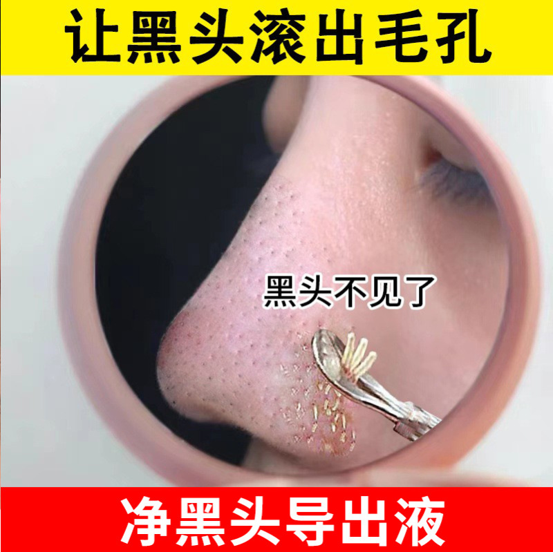 美容院の大きい瓶の500mlの黒い頭の導き出し液の深層は顔をきれいにして温和に黒い頭の毛穴に行って口を閉じます。|undefined