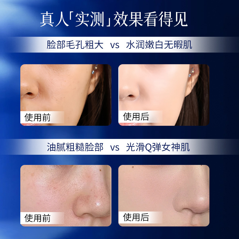 美蒂抖音同款微针收缩毛孔精华液30ml 补水保湿抗皱紧致微晶安瓶|undefined