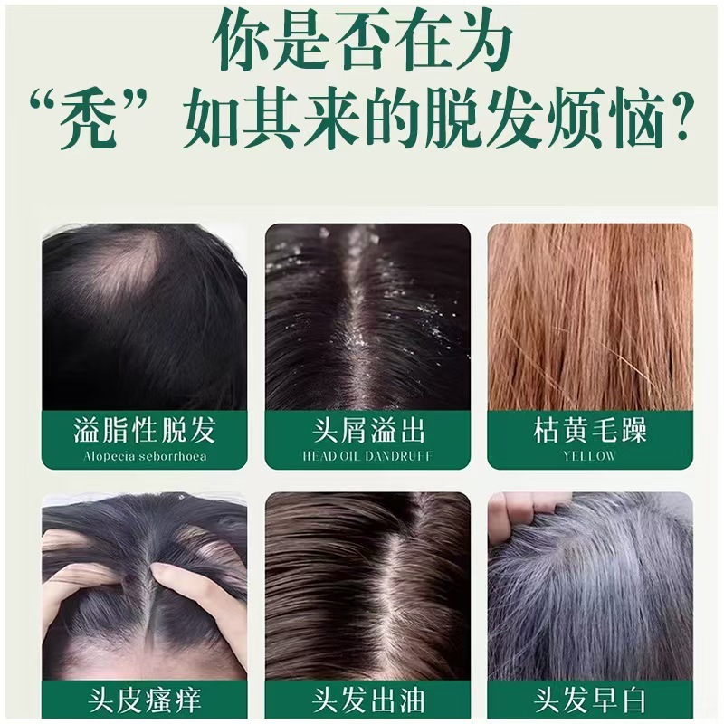 香港薬局ハーブシャンプーパウダーヘアセラピースープ独立パックシダーフリーバーフリーパウダー大量卸売|undefined