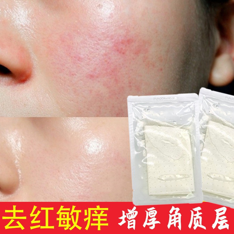Hydrating and Repairing Mask for Sensitive Skin, Beauty Salon Laser Post-Treatment Redness and Itching Hormone Face Thickening and Cuticle Repair Mask