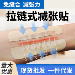 九院の同タイプの医療用縫いなしの針の減量器のチェーン式の傷口は縫いなしで皮膚の傷口を貼り付けて癒合します。