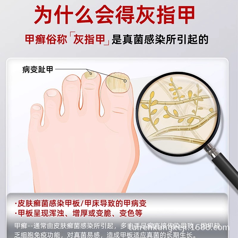 Máquina de fototerapia de uñas grises domésticas esterilizantes ultravioletas lámpara láser de hongos herramientas de cuidado de uñas para el tratamiento JJ