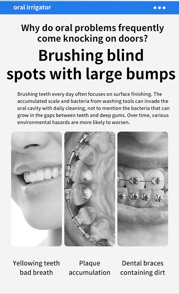 Portable Dental Irrigator, Electric Oral Cleaner, Handheld Dental Cleaner, Stone Removal, Water Flosser, Dental Floss_voghion.com