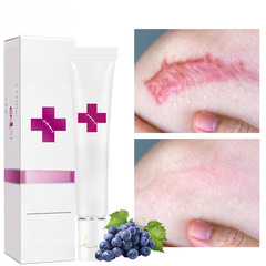 RtopR Repair Remove Scar Cream qu hen Cream AliExpress Cosmetics RtopR028