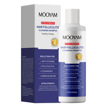 shampooë���坍ϴ�lˮȥм���ϴ�^ϴ�lˮ����^Ƥ����ϴ�lҺ