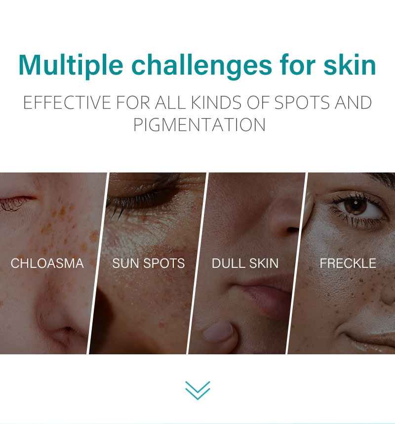 去黑斑色素霜-详情_02.jpg