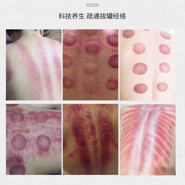 2025 新しいライフエネルギーボディアンチエイジング器具 Mai Jiaxin Xin グラビング理学療法肩、首、頭の治療浚渫マッサージ美容|undefined
