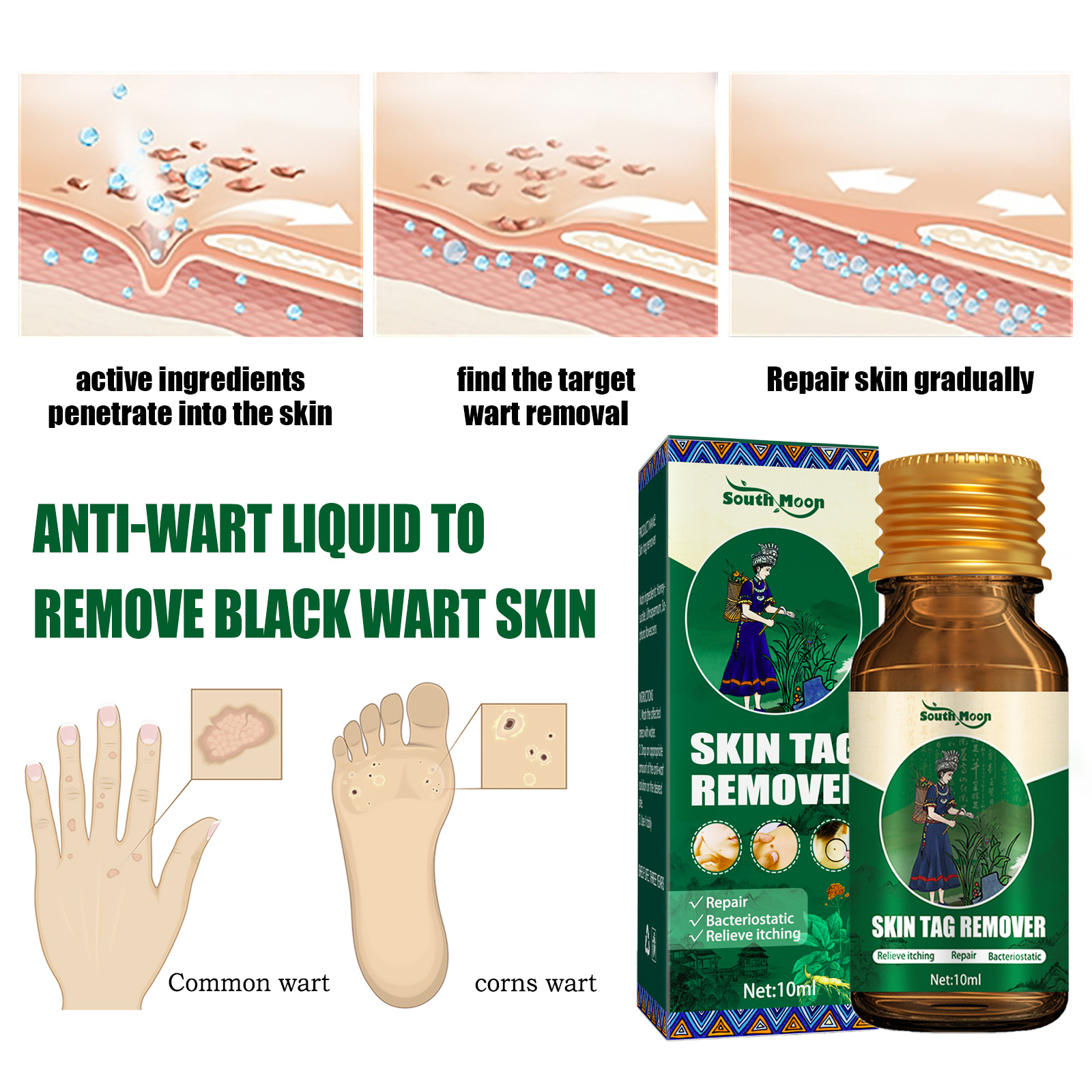 2024 wart remover to lighten flesh thorns, flat skin, especially corns, body warts, and filamentous warts_voghion.com