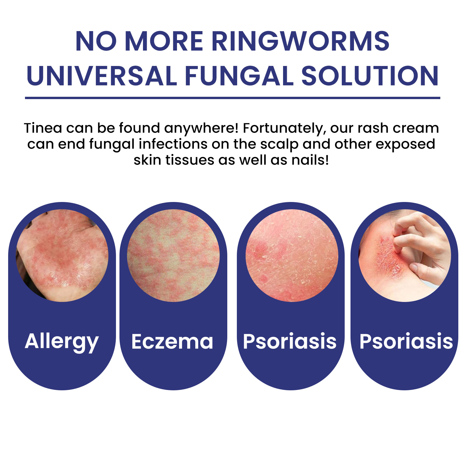 South Moon Skin Repair Cream herstelt de moshuidbarrière, verlicht roodheid en jeuk, hydraterende huidcrème_voghion.com