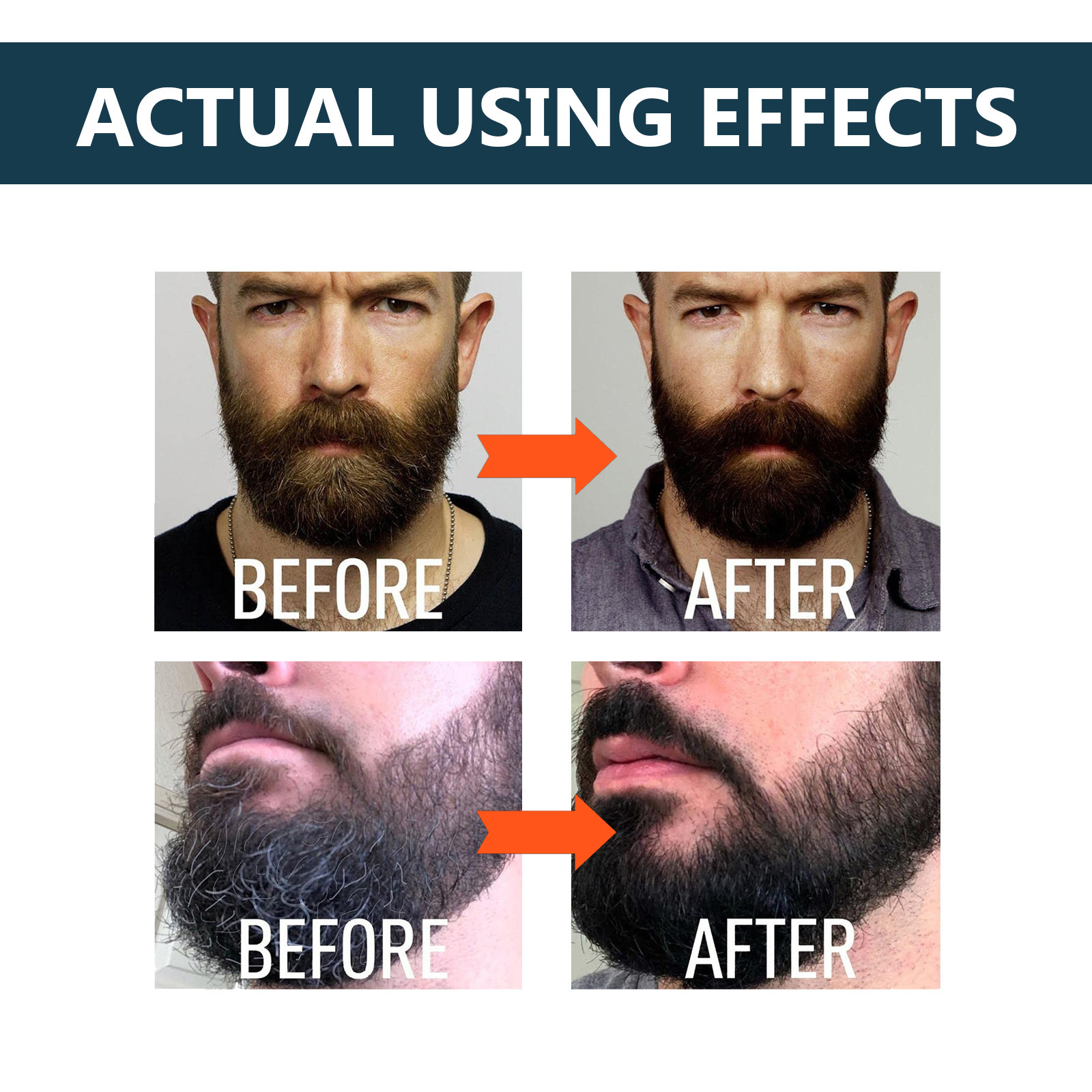 East Moon Liquid Soften Brighten Men's Beard Strong and Tenacious Fiber Roots Nourish Thick Care essence_voghion.com