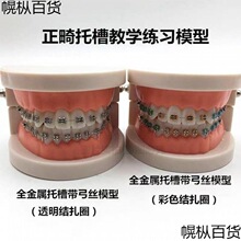 牙齿模型牙科正畸带托假牙模型 医患沟通教学模型 矫正练习托