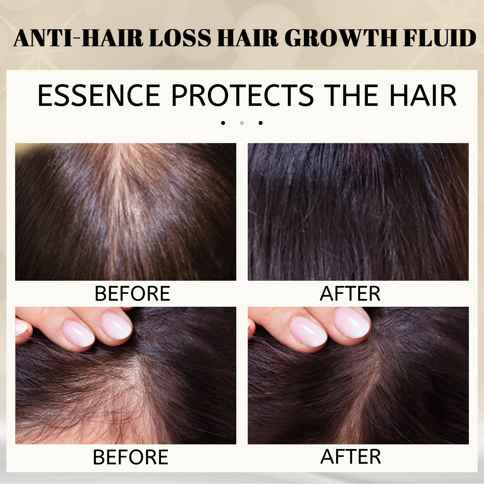 prevention Hair loss solution, growth nutrition, root massage, scalp follicle damage repair, strong and tough_voghion.com