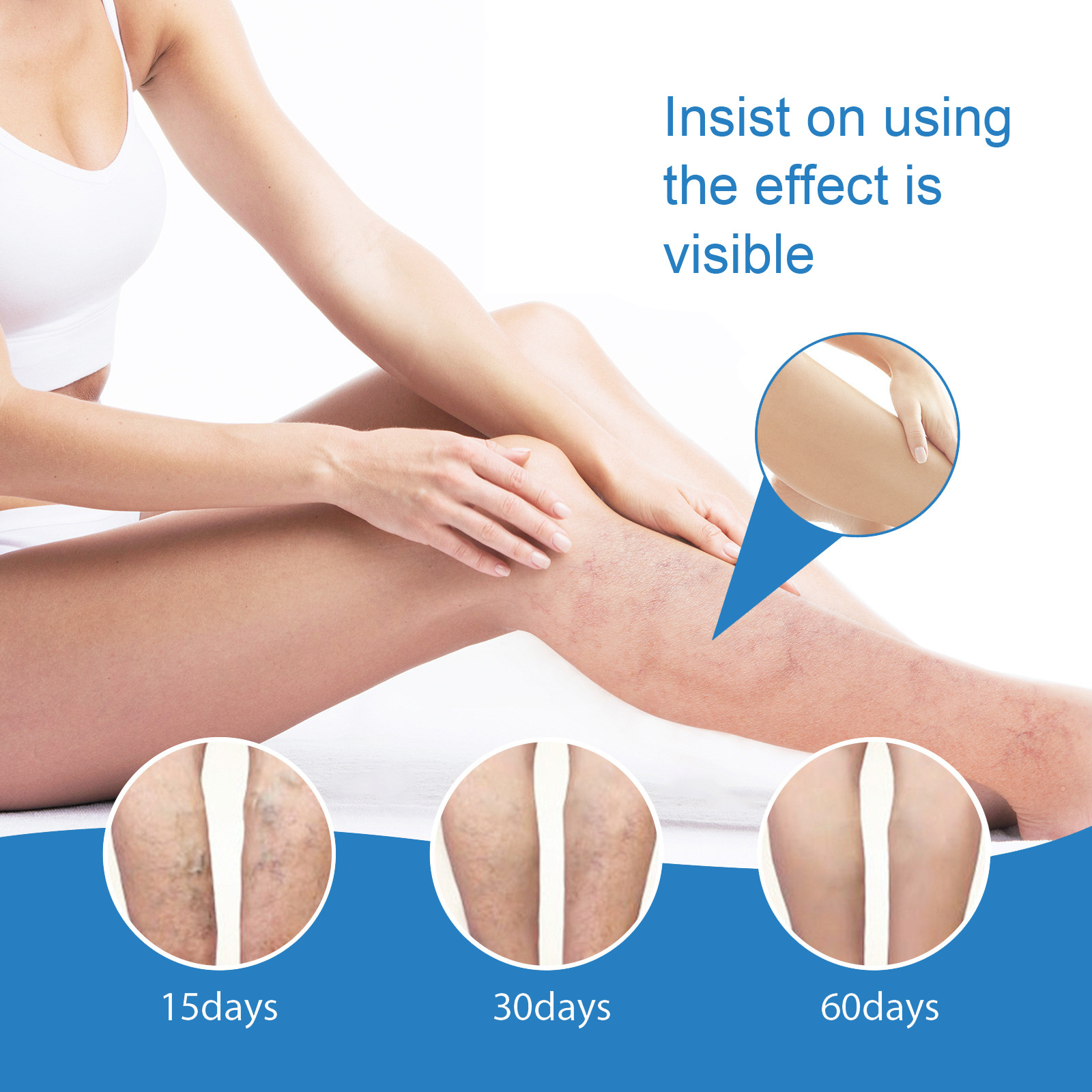 EELHOE Repair-masaje calmante de venas venosas, alivio de varices, crema para el dolor abultado Vascular de las piernas_voghion.com