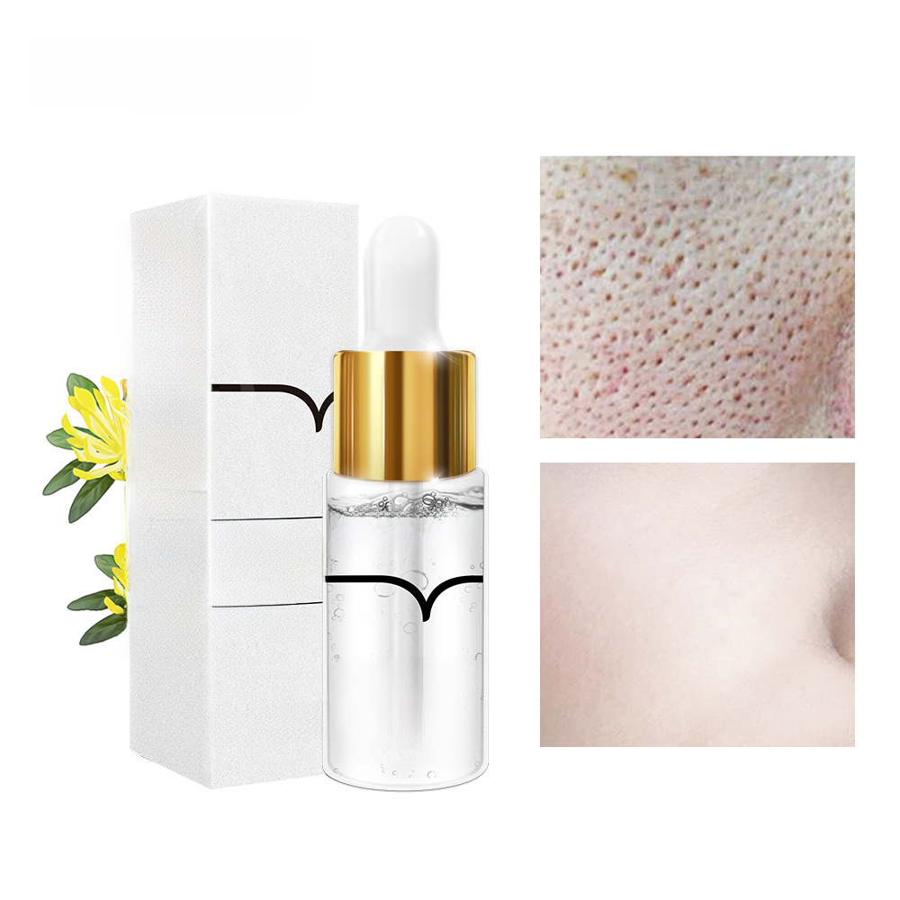 LANBENA PORE TREATMENT Serum Lan Beina Pore Essence 15ml