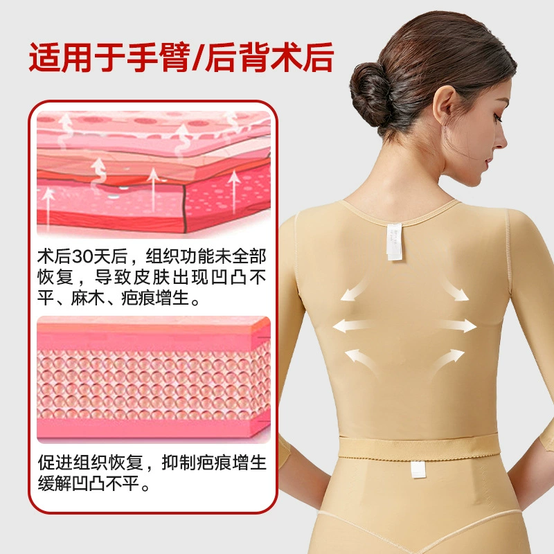  after liposuction