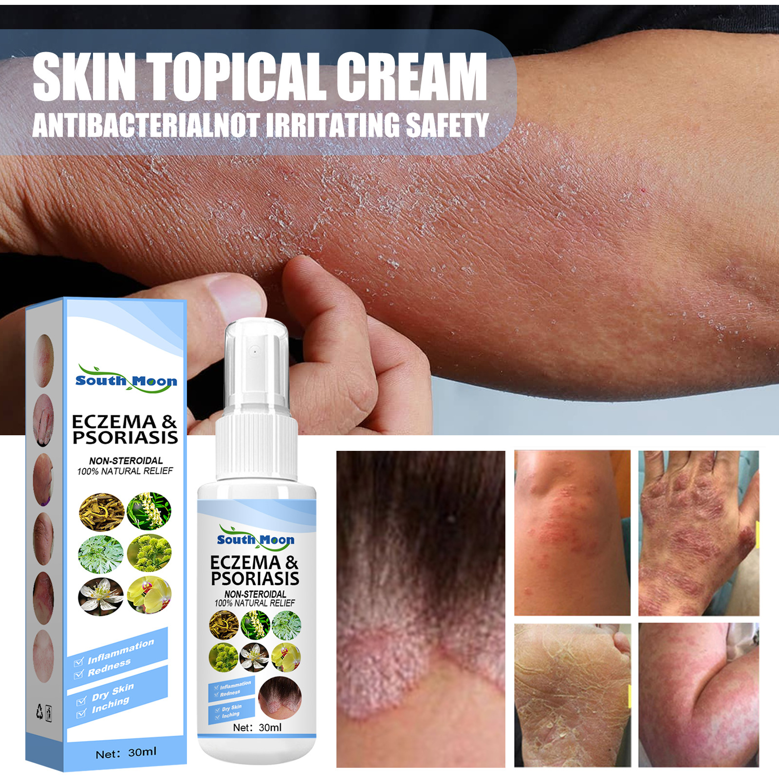 South Moon skin repair spray, moss psoriasis, topical athlete's foot spray, skin antibacterial spray_voghion.com