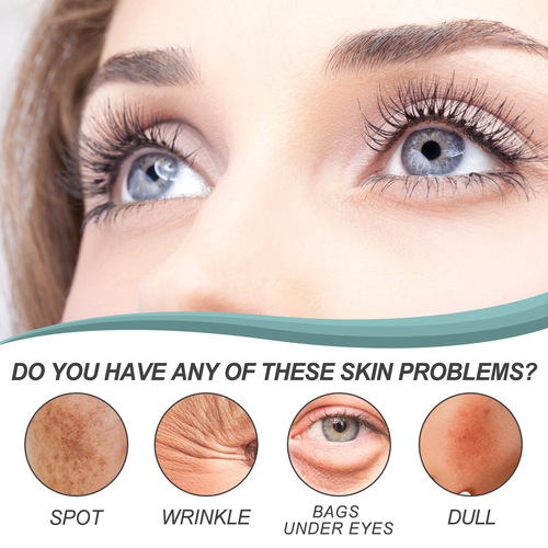 EELHOE Dark Spot Corrector Cream Moisturizing and Fading Skin Dark Spots Melanin Rejuvenation Brightening Whitening Cream