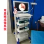 齐全摄像耳鼻喉鼻镜